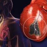 Indwara zitandura nk’umutima ku isonga mu kwica abantu benshi
